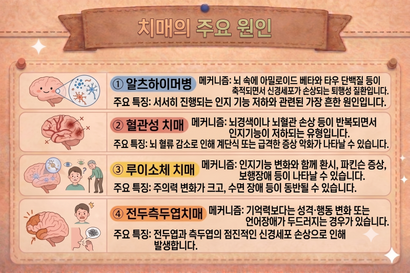 치매 초기증상부터 검사·치료까지 총정리! 알츠하이머와 치매 차이는?