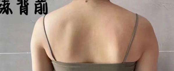 저주파물리치료기 집에서 뭉친 근육 피로를 풀어주는 기기 팁
