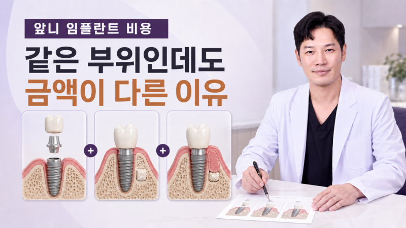 서대문 치과 앞니 임플란트 비용, 뼈이식과 잇몸이식이 더해질 때 달라지는 구성