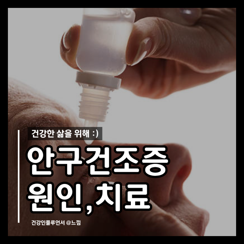 안구건조증 증상 안약 치료방법 렌즈