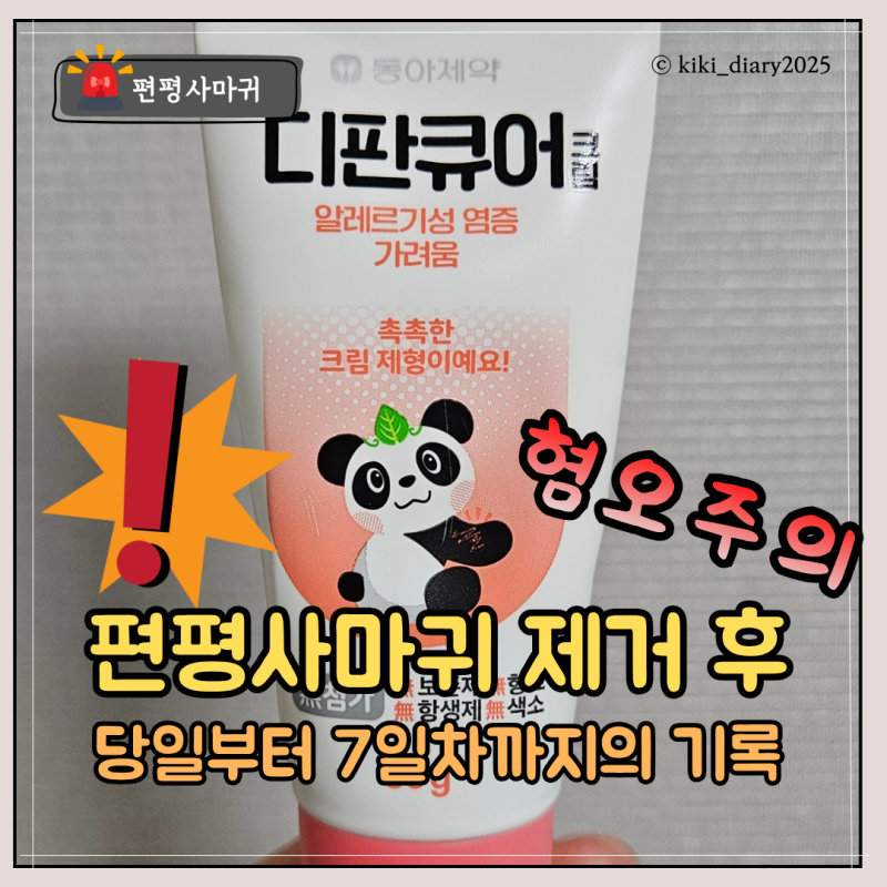 [혐오주의] 편평사마귀 제거 후, 당일부터 7일차까지 관리 후기 및 관리팁