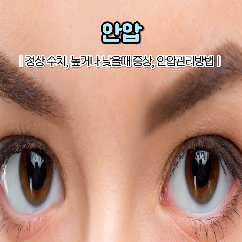 안압 정상수치와 안압 높을 때 증상, 안압 낮추는 법