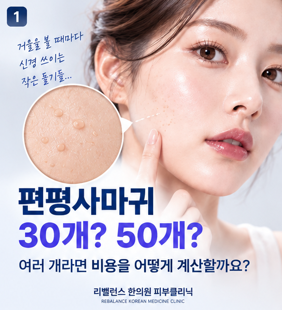 편평사마귀가 30개, 50개 이상이라면? 여러 개 제거할 때 비용 계산하는 방법