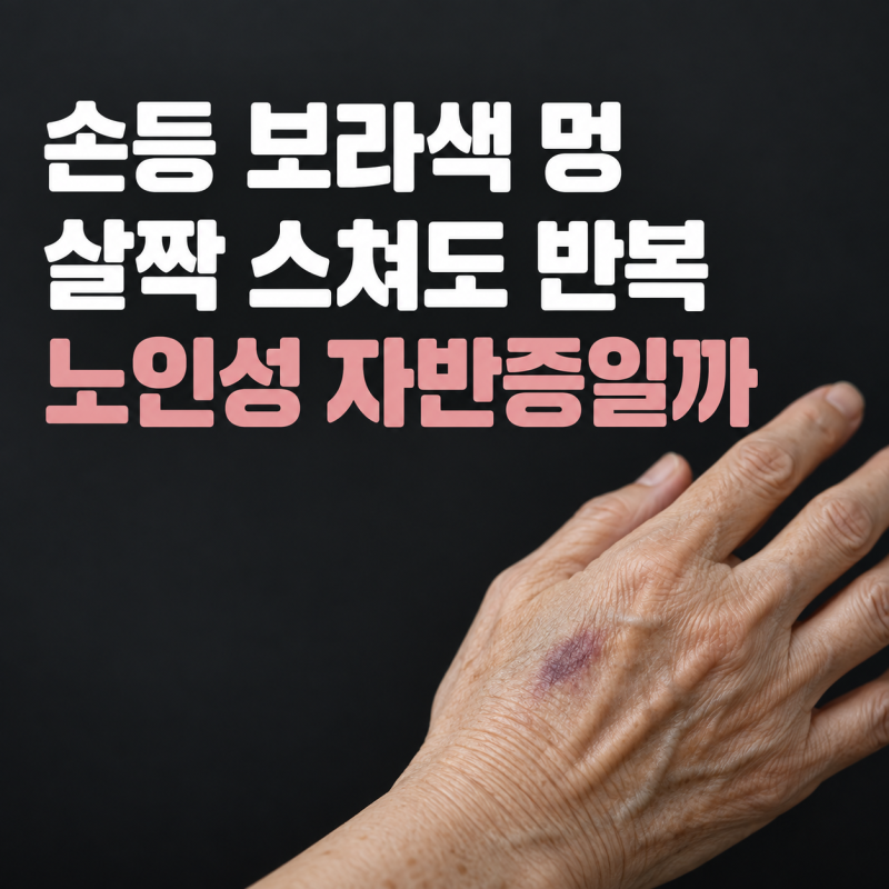살짝 스쳤는데 손등에 보라색 멍, 노인성 자반증일까?