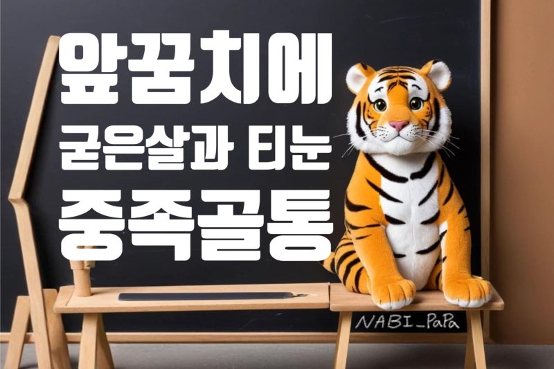 발바닥 앞쪽이 아프고 굳은살·티눈이 반복된다면? 중족골통과 DMMO 수술