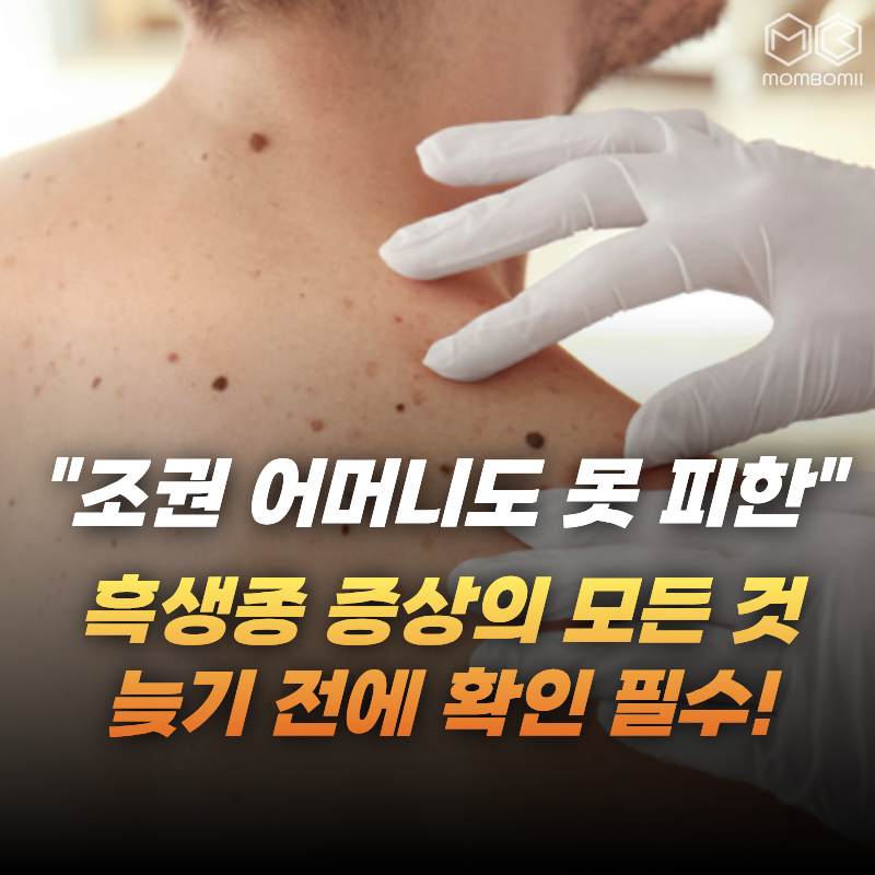 "김혜수가 눈물로 도와줬다더니…" 조권 어머니 발가락 앗아간 '흑색종' 증상은?