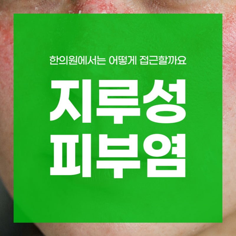 지루성 피부염 치료 방법, 한의원에서는 어떻게 접근할까요