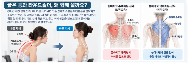 굽은 등, 라운드 숄더(교정기 효과?, 셀프 교정운동)