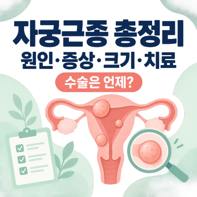 자궁근종 총정리｜원인·증상·크기·치료, 수술은 언제 할까?