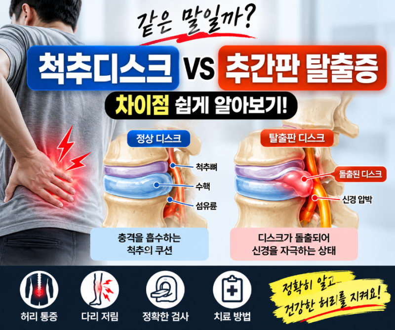 허리디스크 파열 증상 및 수술전ㆍ수술후 솔직 후기