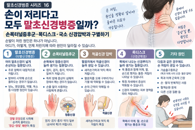 손이 저리다고 모두 말초신경병증일까ㅣ손목터널증후군·목디스크·국소 신경압박과 구별하....