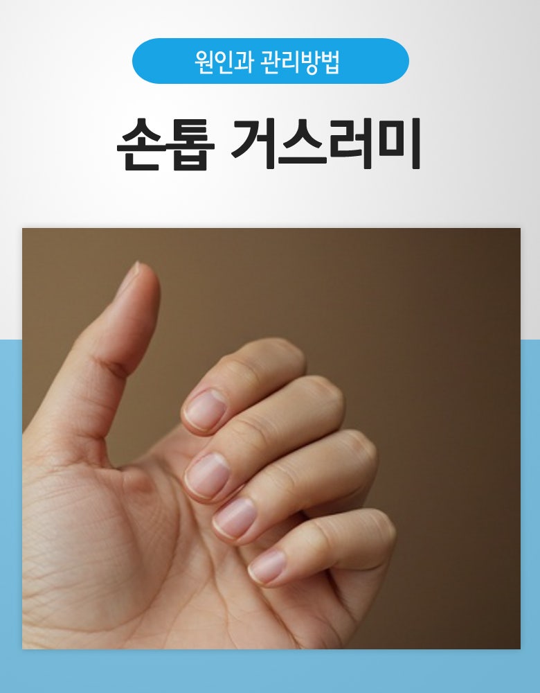 손톱거스러미 원인 & 관리방법