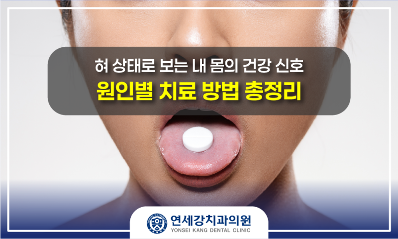 [광주 학동 연세강치과] 혀 상태로 보는 내 몸의 건강 신호, 원인별 치료 방법 총정리