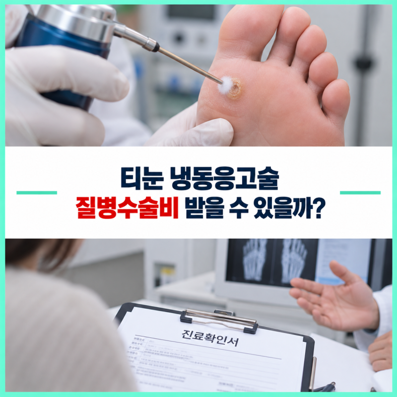 티눈 냉동응고술 질병수술비 받을 수 있을까? 피부질환 면책조항 확인법