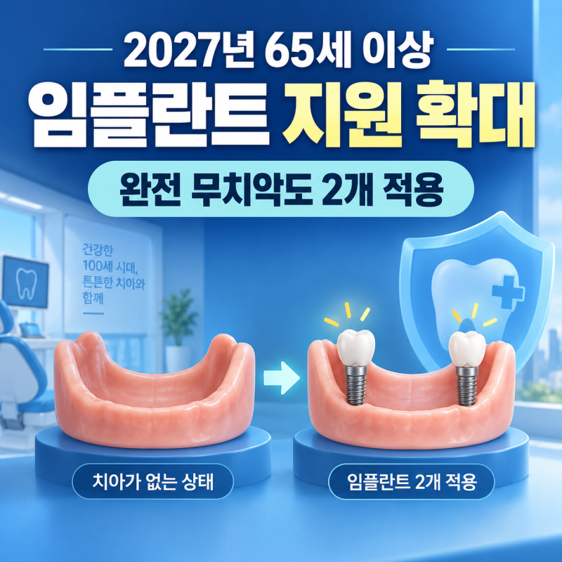 2027년 65세 이상 임플란트 지원 확대, 완전 무치악도 2개 적용