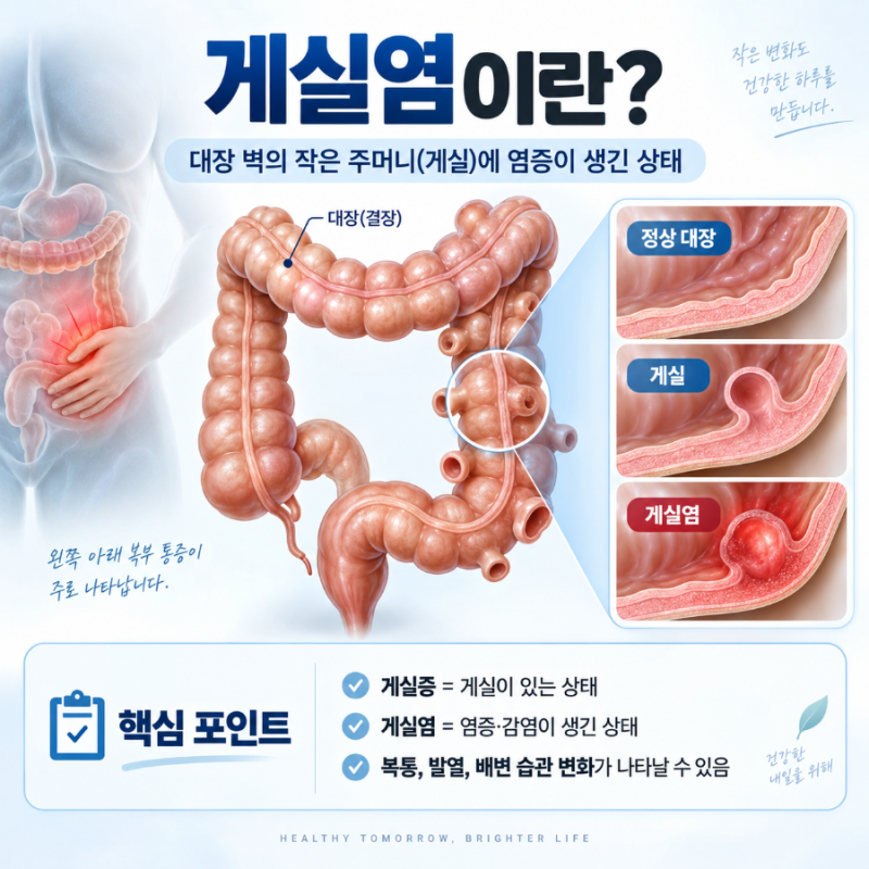 게실염 증상, 원인, 치료, 왼쪽·오른쪽 아랫배 통증, 음식, 항생제, 입원·수술 등 총정리