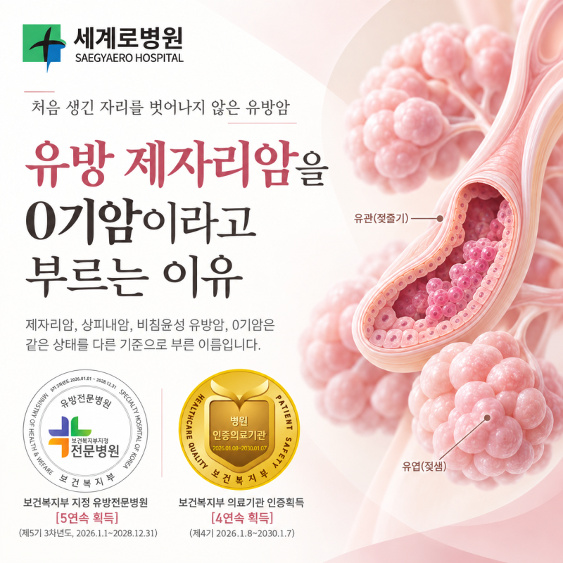 유방 제자리암을 0기암이라고 부르는 이유
