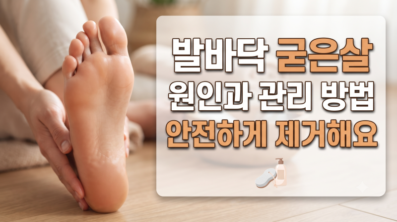 발바닥 굳은살 원인과 관리 방법 5가지, 안전하게 제거해요