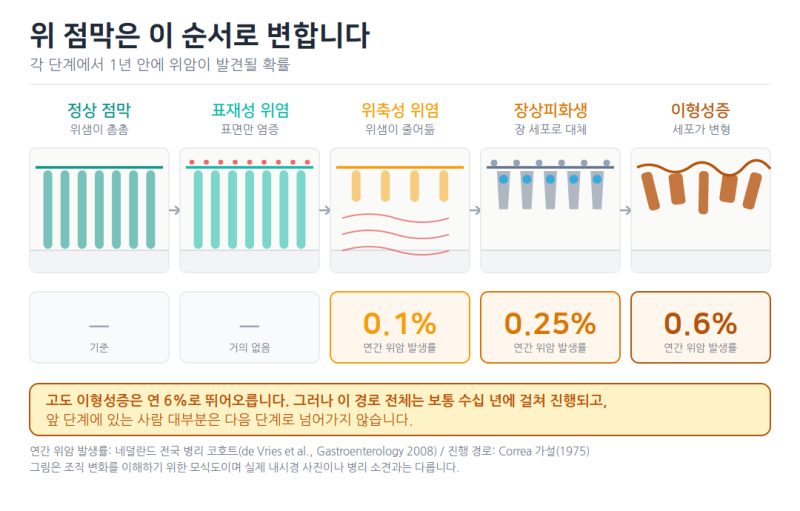 장상피화생 위암 확률, 50대 내시경 결과지 숫자로 따져봤습니다!