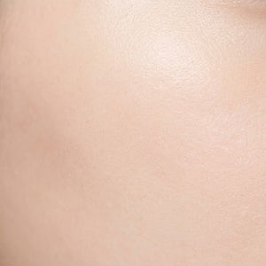 리도멕스·락티케어 바르는 방법, 스테로이드 연고 등급