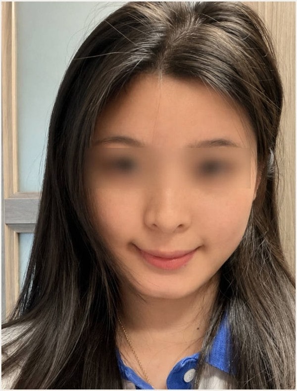 프로토픽 연고 부작용 요즘 제 피부 상태