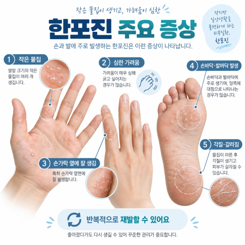 한포진 원인, 증상, 치료, 연고, 전염, 재발 등 총정리