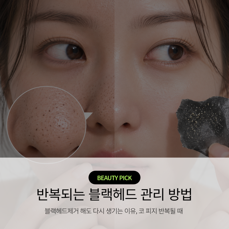 블랙헤드제거 해도 다시 생기는 이유, 코 피지 반복될 때 없애는 법