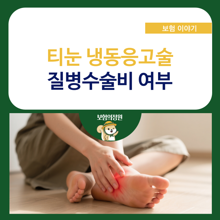 티눈 냉동응고술 질병수술비 보장 가능할까?