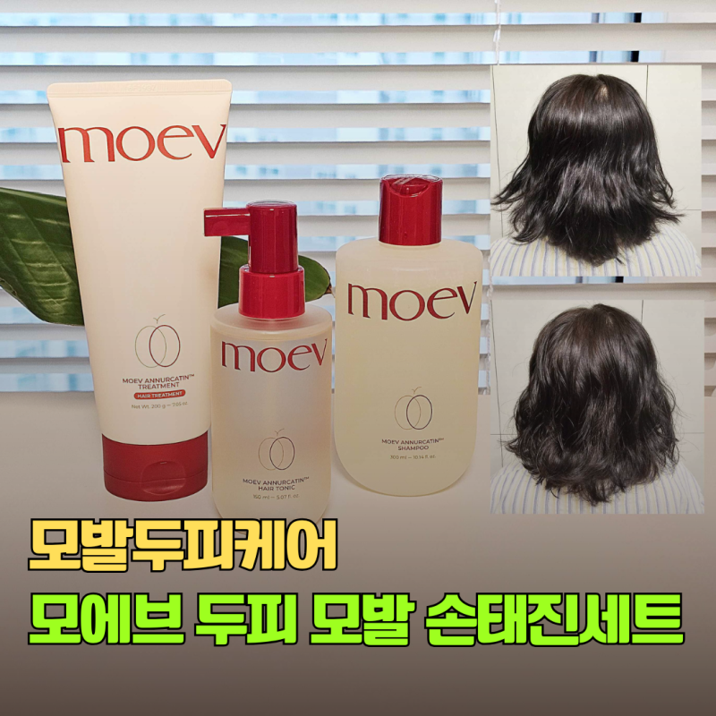 손태진 유튜브에서 본 모에브 두피 모발 탈모 케어 샴푸, 트리트먼, 헤어토닉