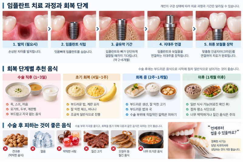 임플란트 심고 언제부터 씹어도 될까? 수술 후 식사와 회복기간은 다릅니다