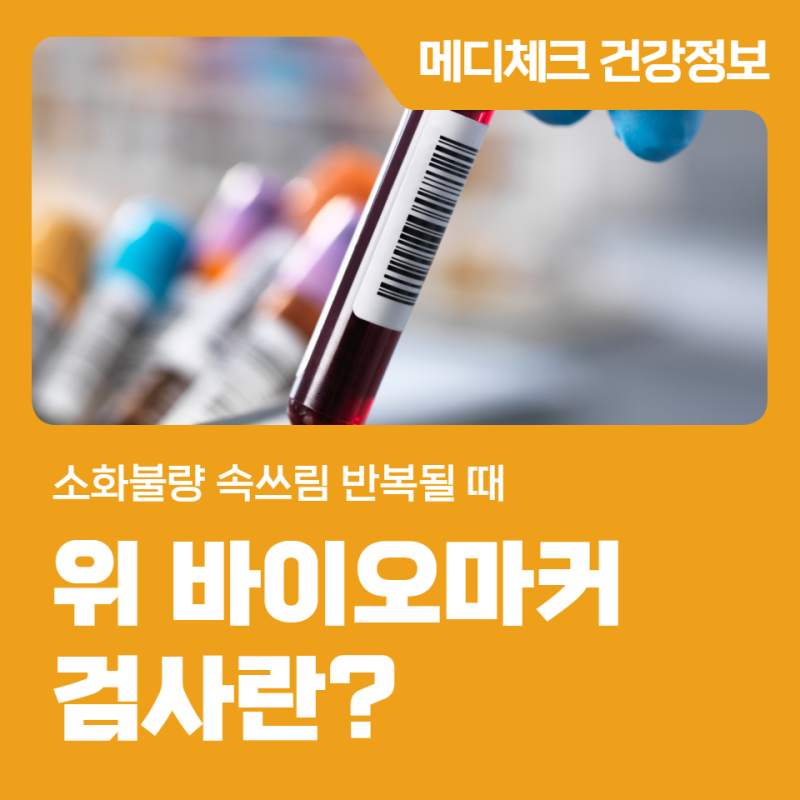 금정구 건강검진 위 바이오마커 검사란? 소화불량 속쓰림 반복될 때