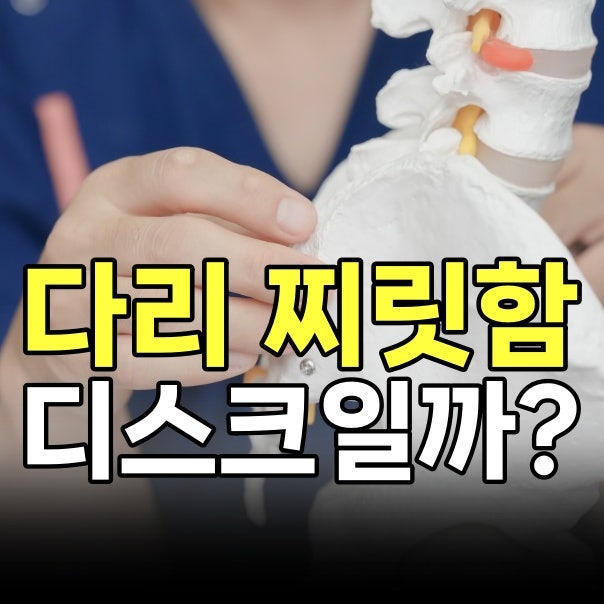 허리는 멀쩡한데 다리만 찌릿 방치했다 큰일 나는 다리저림 원인