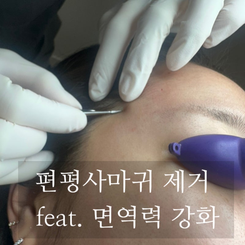영등포 생기한의원 편평사마귀 제거 후기 ㅣ 면역치료(한약)로 편평사마귀 박멸하기