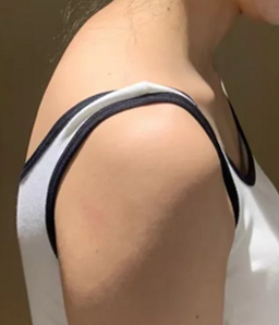어깨 염증 주사 관절 통증과 부기를 가라앉히는 치료 특징