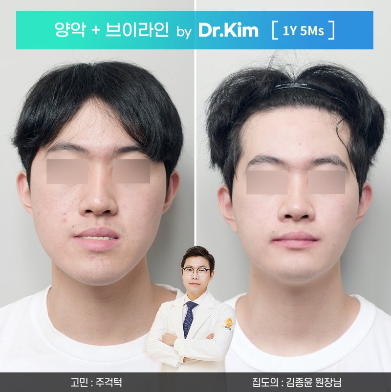 김종윤 원장님ㅣ구강악안면외과 양악수술 병원 선택 시 확인해야 할 기준