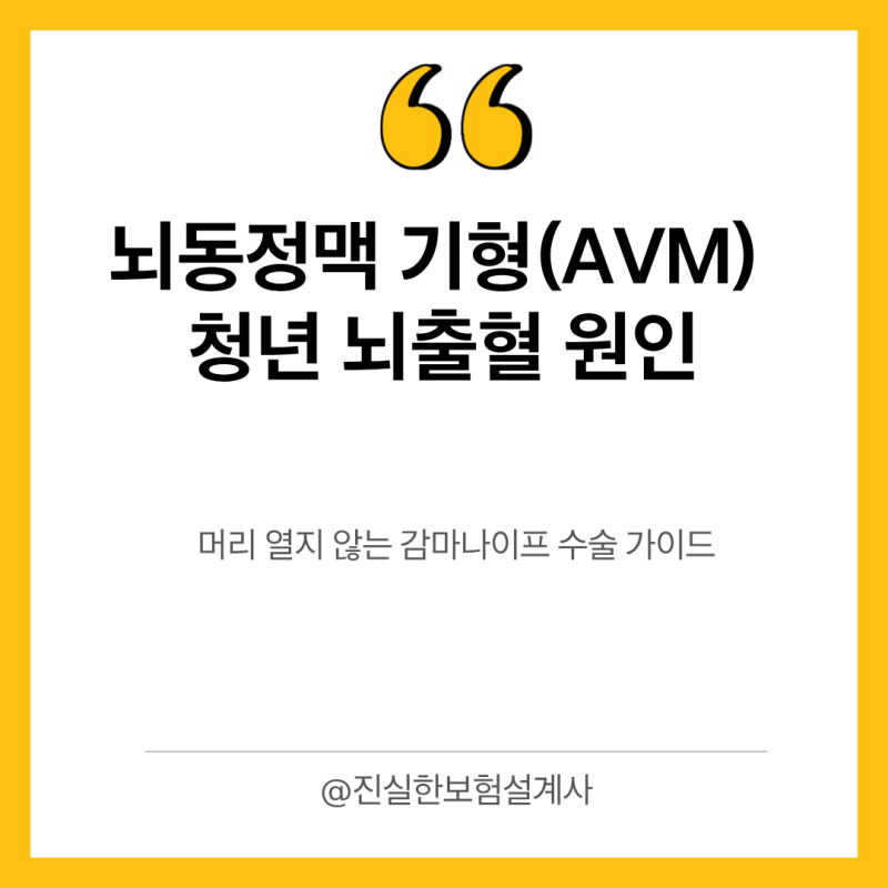 뇌동정맥 기형(AVM) 청년 뇌출혈 원인과 머리 열지 않는 감마나이프 수술 가이드