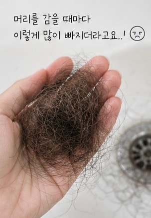 산후탈모, 머리가 한 움큼씩 빠져서 찾아봤어요｜시기부터 영양제·관리법까지