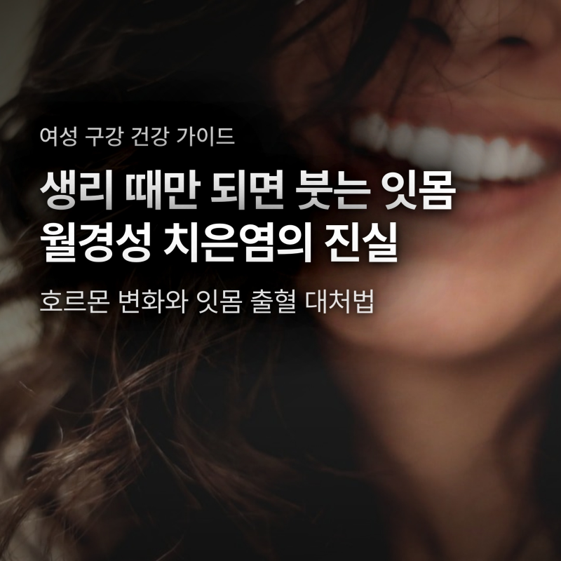 생리할 때마다 잇몸 붓고 피나는 이유, 단순 피로 아닌 치석 경고일까?