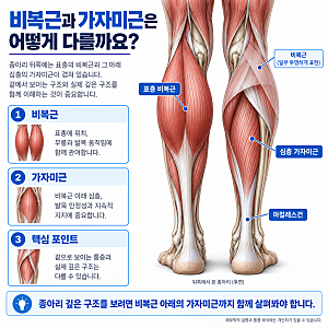 종아리 통증 위치가 다르면 원인도 다를까? 비복근·가자미근부터 아킬레스건까지