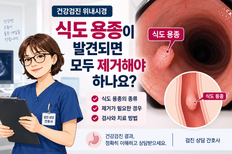 건강검진 위내시경에서 식도 용종이 발견되면 모두 제거해야 하나요?