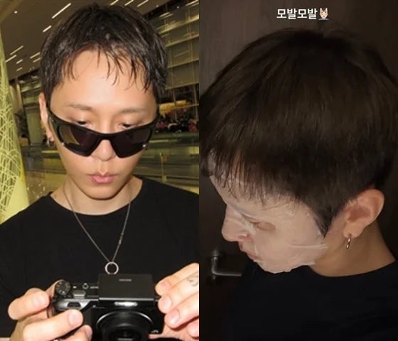 용준형 탈모설 진짜였나? 직접 공개한 정수리 사진에 팬들 안도