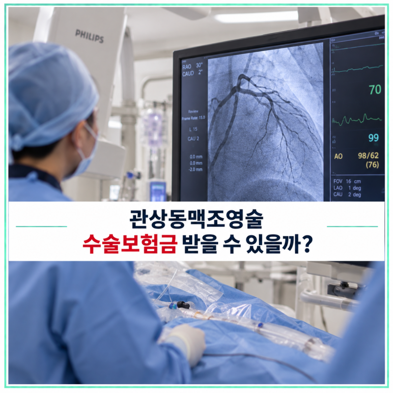 관상동맥조영술 수술보험금 받을 수 있을까? 검사와 치료를 가르는 기준