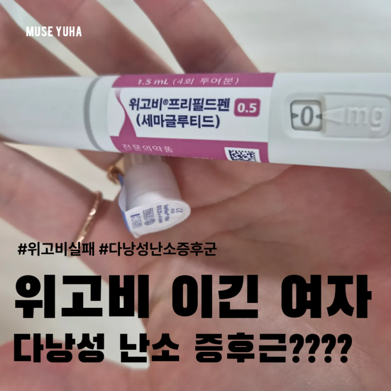 위고비2달 효과 없음. 다낭성난소증후군(PCOS)때문일까.
