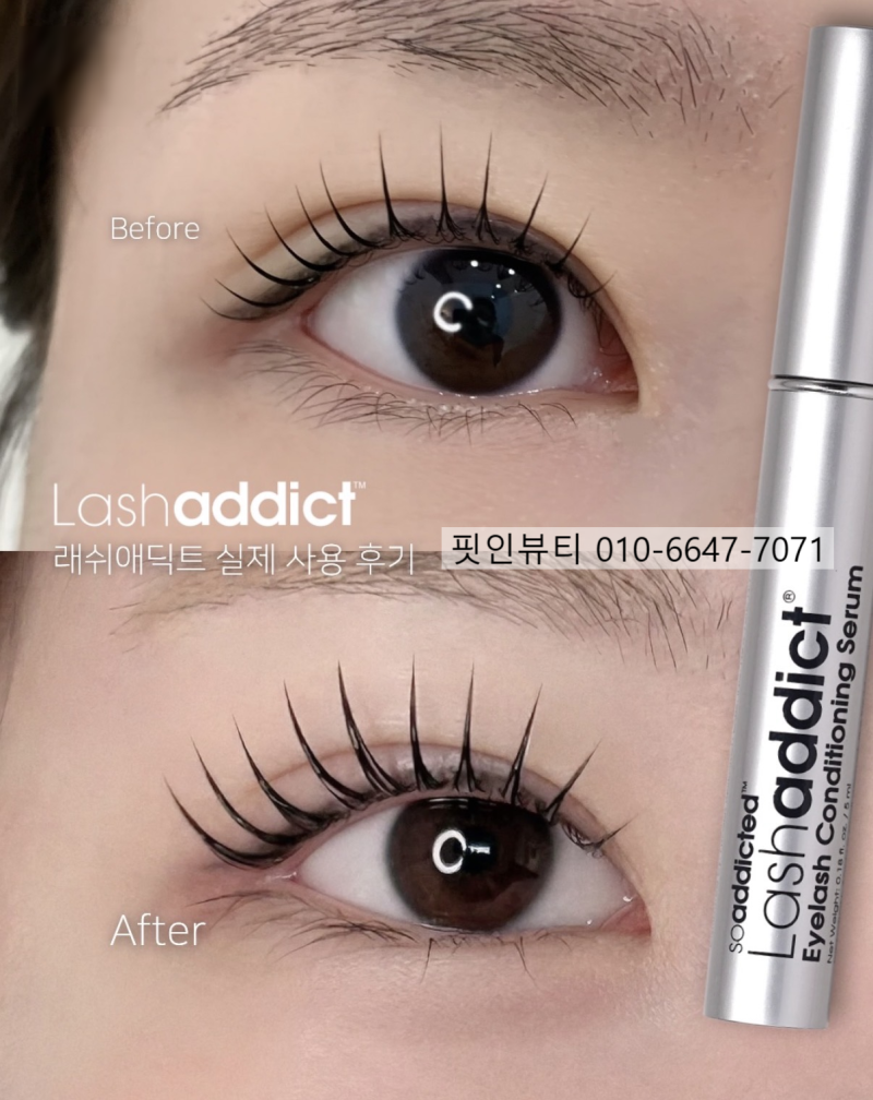 래쉬애딕트 효과 좋은 영양제 생장제 후기와 정품 구매 방법(+사용법)