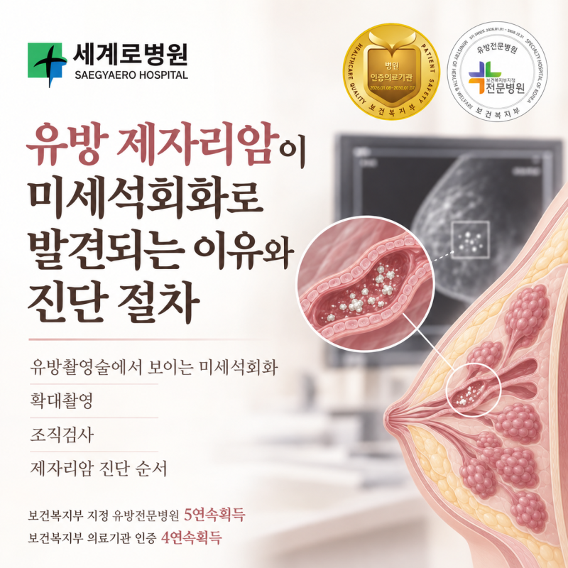 유방 제자리암이 미세석회화로 발견되는 이유와 진단 절차