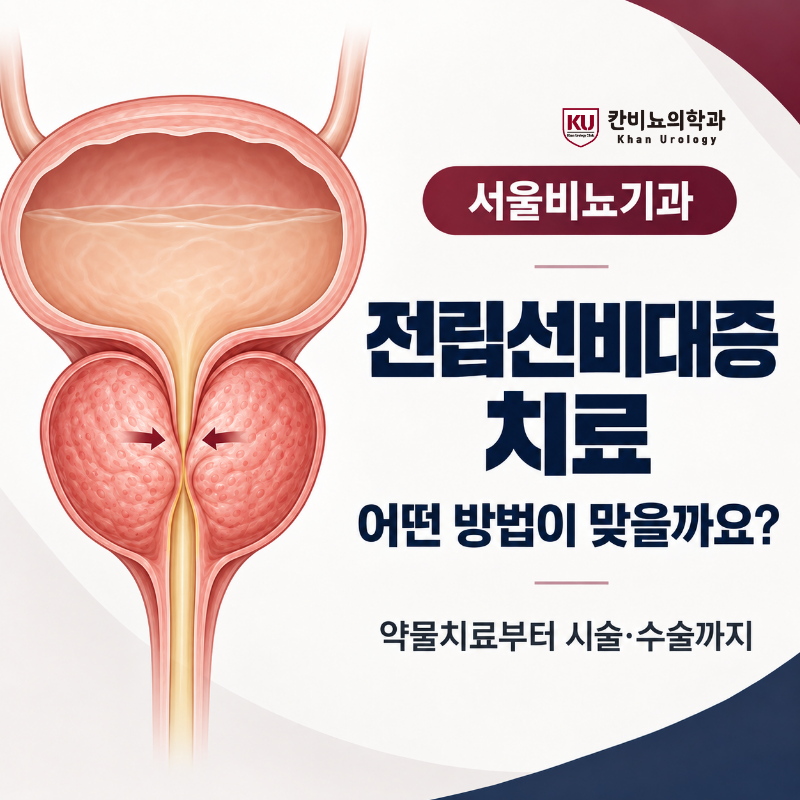 서울비뇨기과 전립선비대증 치료, 어떤 방법이 맞을까요?