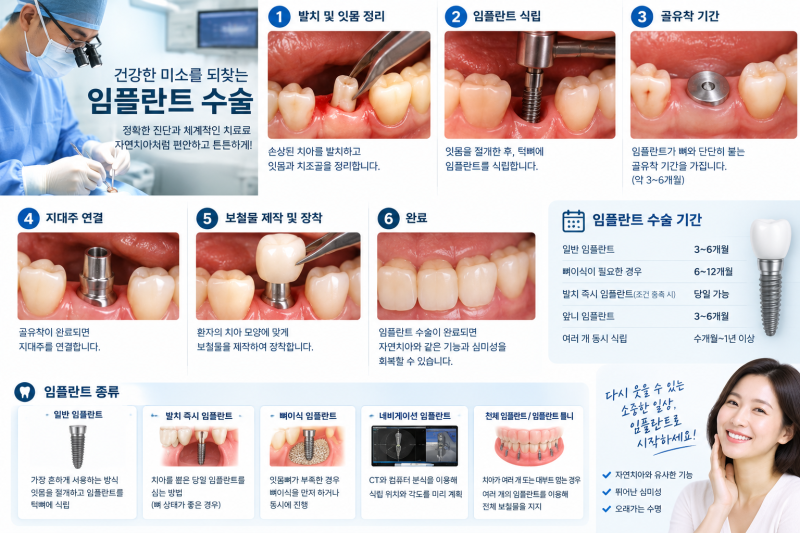 임플란트 "수술 기간 과 종류" 보험 청구 까지!!