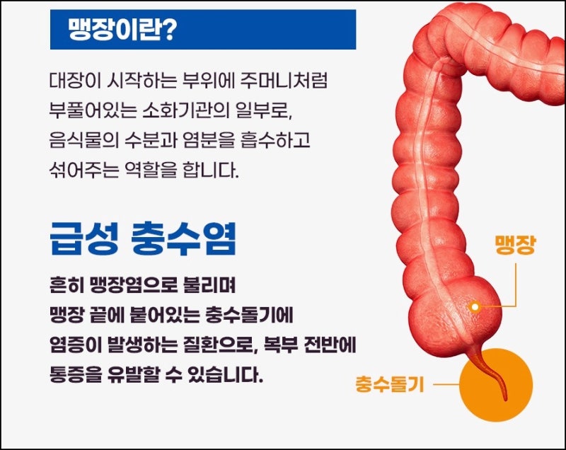 오른쪽 아랫배만 아프면 맹장이다? 통증 위치로 헷갈리기 쉬운 다른 질환들 │ 강북구 응급....