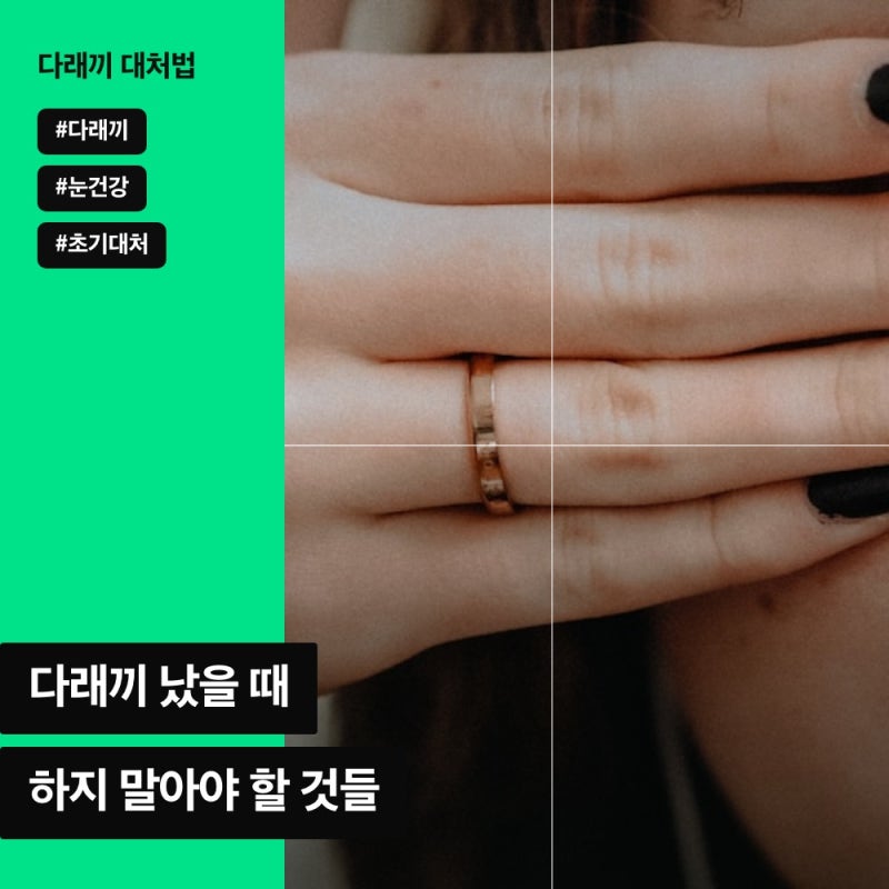 다래끼 하면 안되는것 3가지, 초기대처 안 하면 흉터 남아요