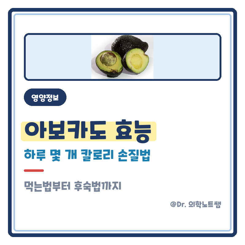 아보카도 효능 먹는법 하루 몇 개 칼로리 손질법 후숙법까지